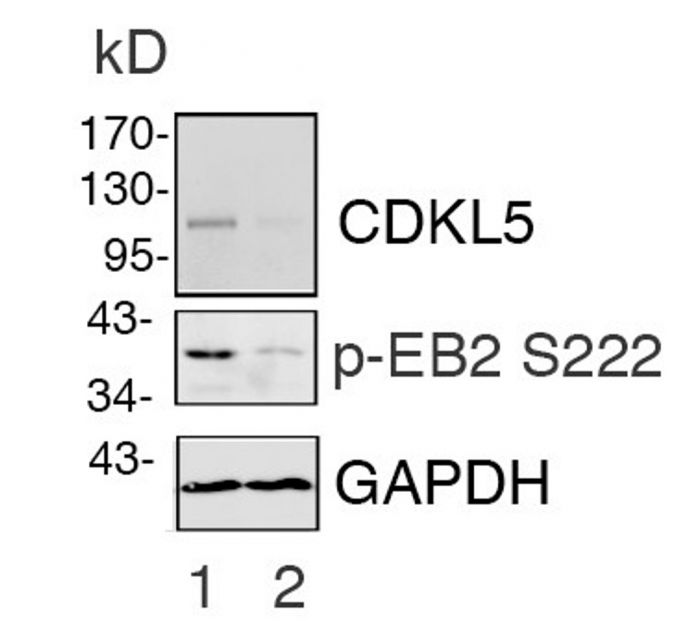 EB2 pS222 antibody